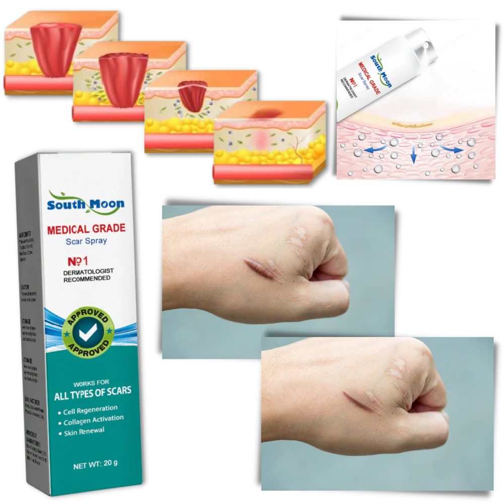 Spray para Cicatrices - 50%OFF -