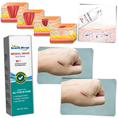 Spray para Cicatrices - 50%OFF -